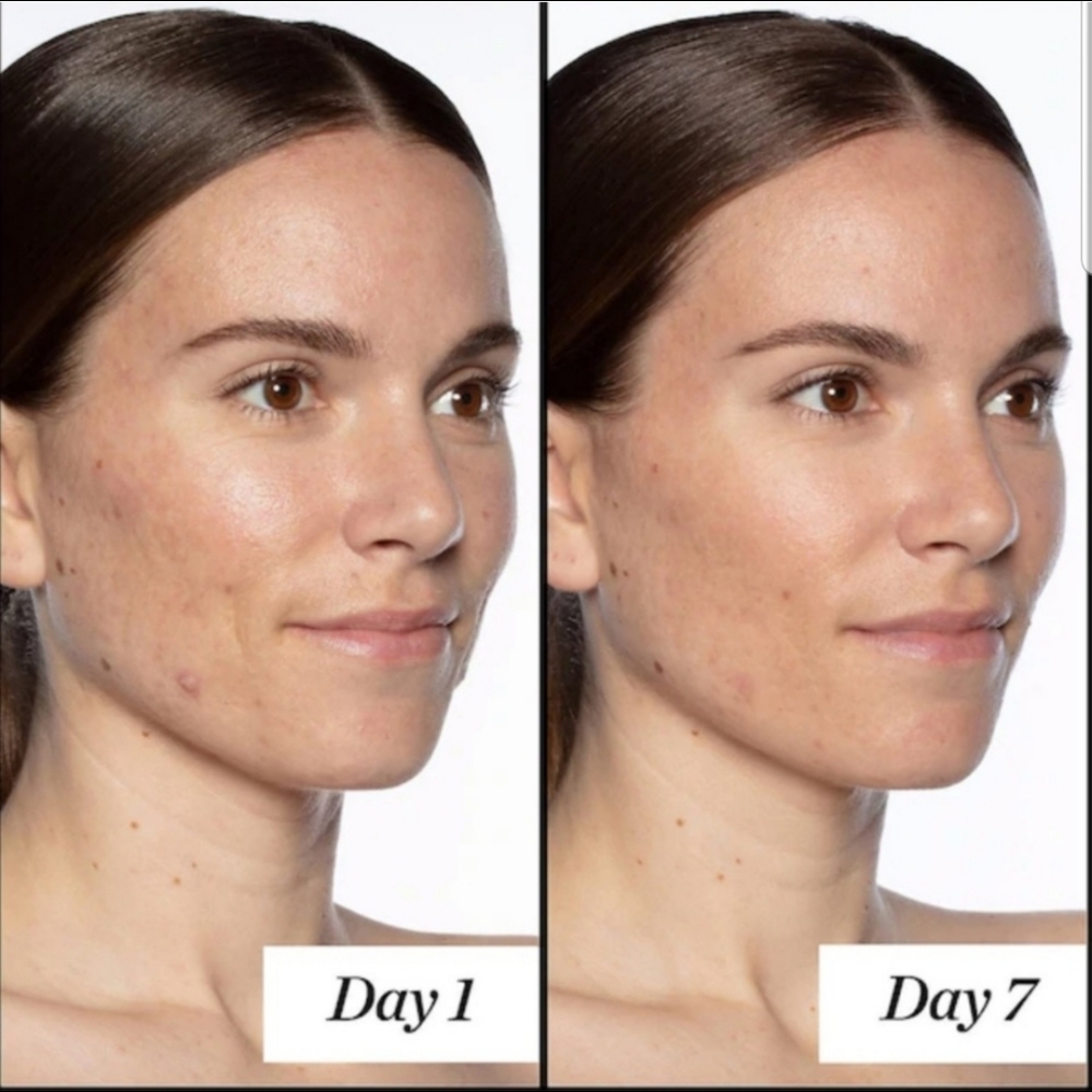 Sunday Riley Good Genes lactic acid treatment - Picture 5 of 6